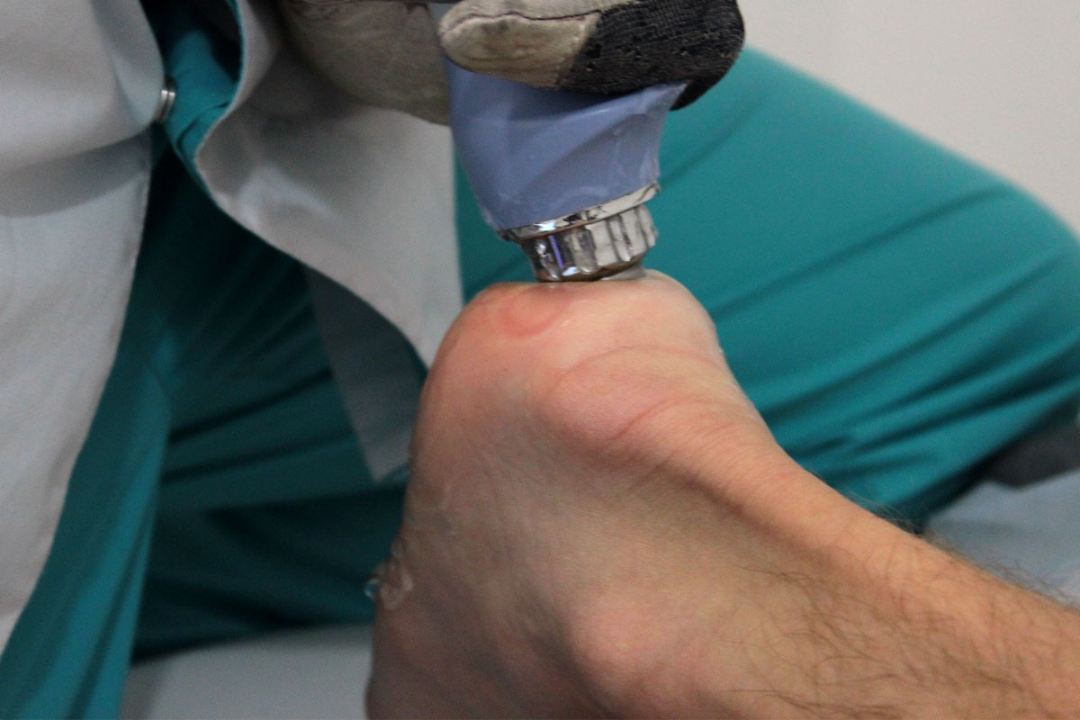 Фото Лечение суставов 4