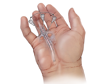 слайдер фото 1