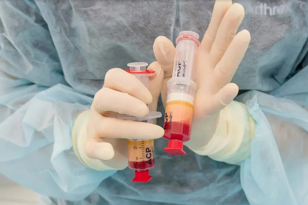 Фото Лечение суставов 5