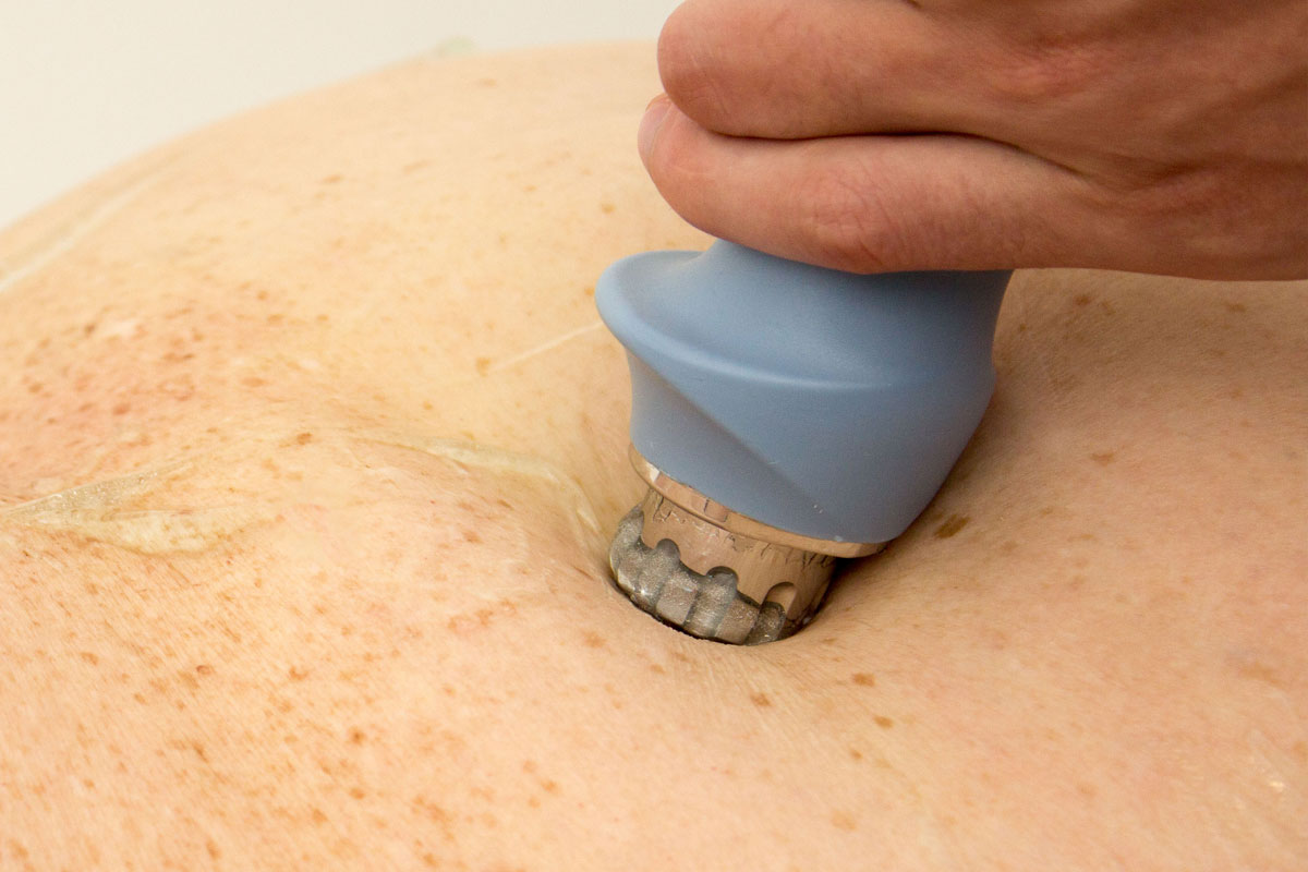 Фото Лечение суставов 6