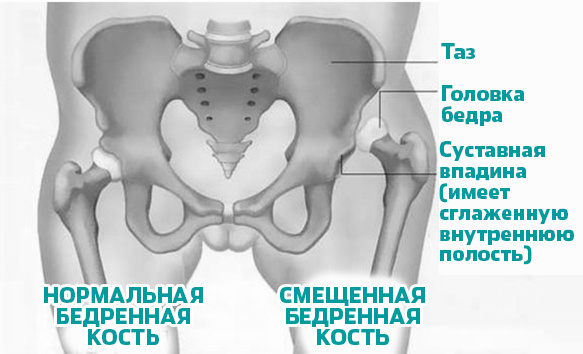 пАТ АНАТОМИЯ дИСПЛАЗИЯ.jpg