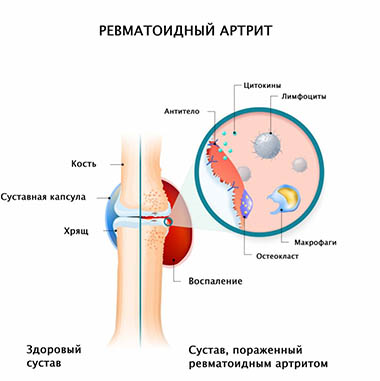 Без имени-1.jpg