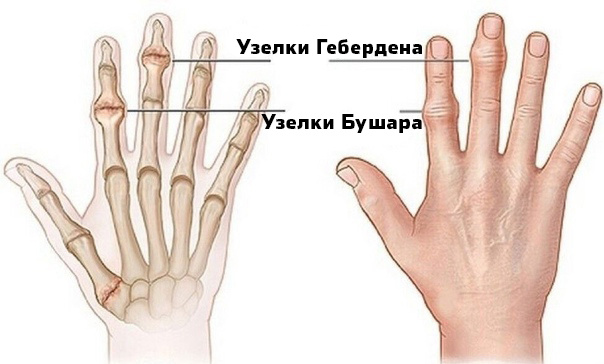 Узелки.jpg